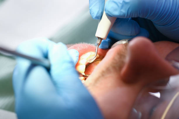 Best Emergency Treatment for Toothache in Florence, MT